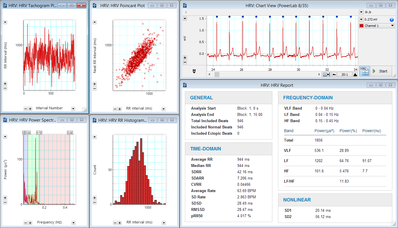 Physiological signal charts